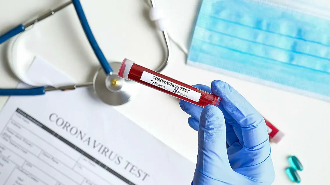 Covid, in Italia 2.278 nuovi casi su 270.044 tamponi e altri 27 decessi